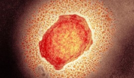 Image via Science Photo Library / ANP