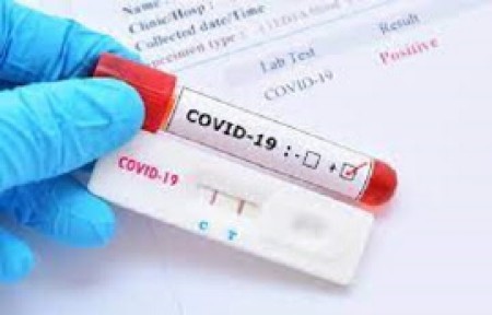 19covidsss