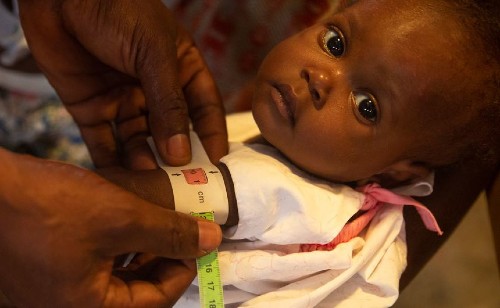 babyhait