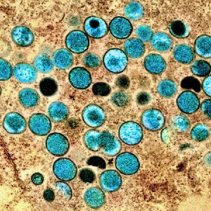 movirus
