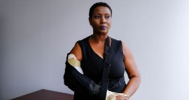 Martine Moise photographed after sustaining injuries during the assassination of President Jovenel Moise over the summer.  Photograph: Maria Alejandra Cardona/The New York Times
