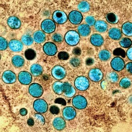 Electron micrograph of monkeypox virus. (NIAID)